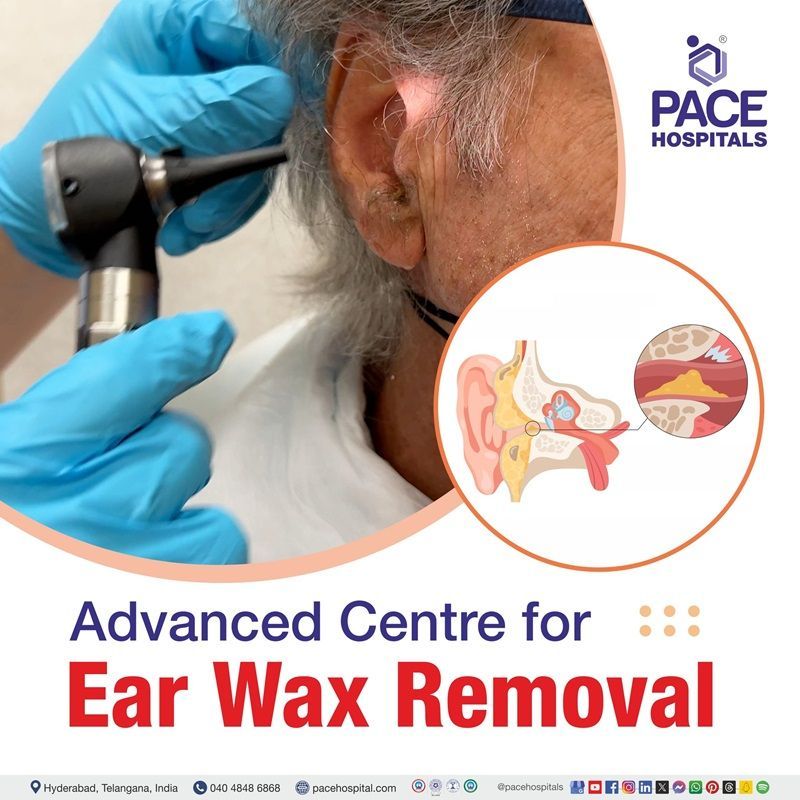 Best ear wax removal hospital in Hyderabad, India | ear wax removal clinic near me | ear wax clinic near me | ear wax removal cost in Hyderabad