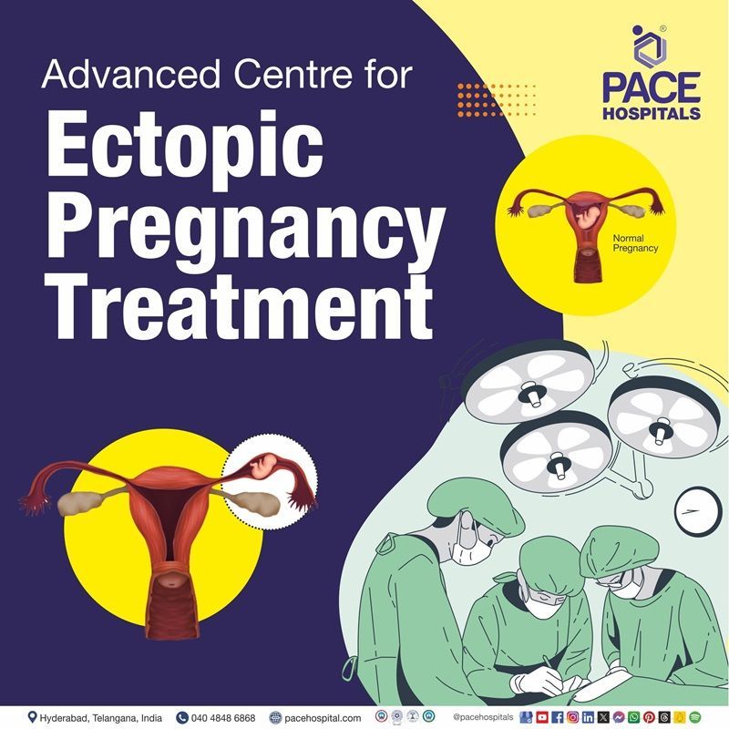 Best Hospital for Ectopic Pregnancy Treatment in Hyderabad | ectopic pregnancy surgery cost in Hyderabad, India | unruptured or ruptured ectopic pregnancy treatment cost | ectopic pregnancy laparoscopic surgery cost
