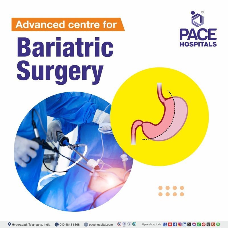 Best hospital for bariatric surgery in Hyderabad | bariatric surgery before and after