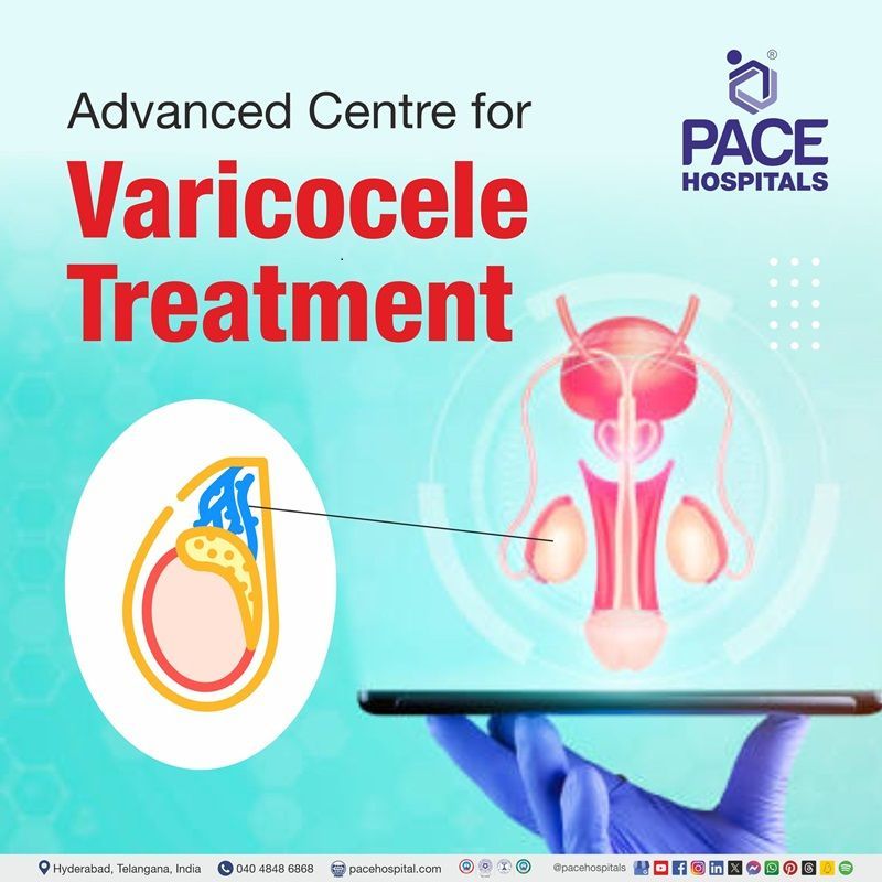 Best Hospital for varicocele treatment in Hyderabad India | varicocele treatment cost in Hyderabad | varicocele treatment hospitals in Hyderabad | varicocele treatment without surgery | varicocele treatment near me