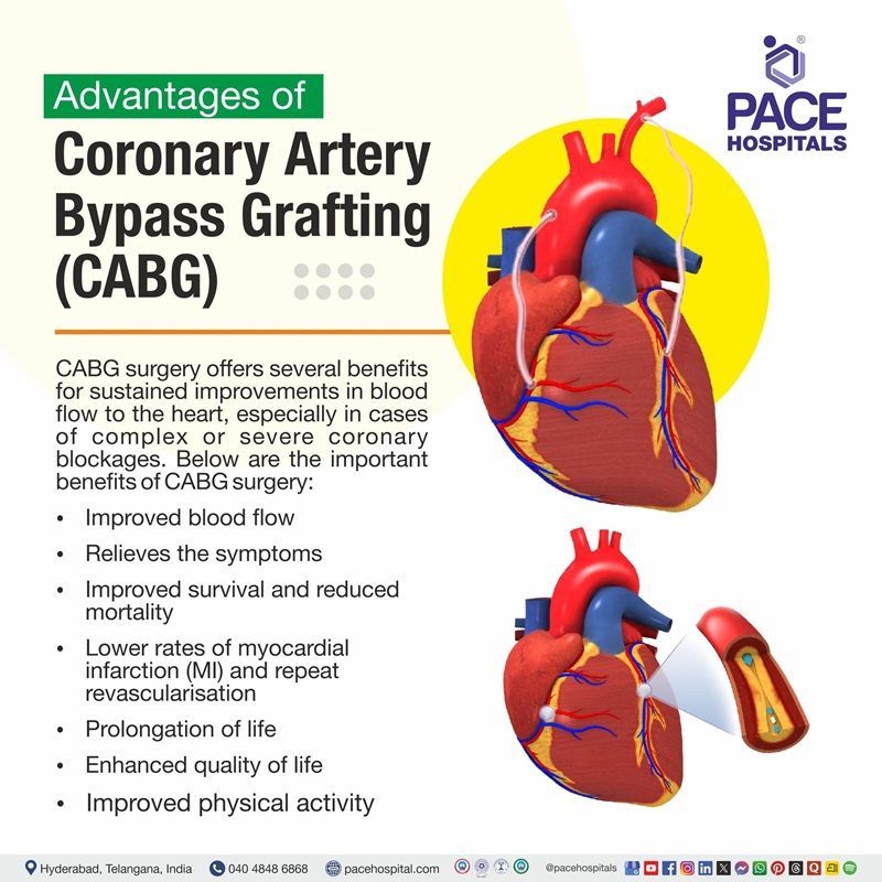 CABG Surgery Benefits Advantages of Coronary artery bypass grafting (CABG) | image depicting the benefits of CABG