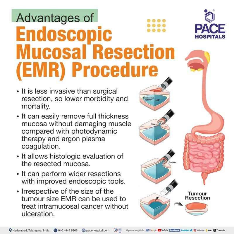 Advantages of Endoscopic mucosal resection (EMR) | endoscopic mucosal resection cost | EMR endoscopic mucosal resection procedure in Hyderabad, India | endoscopic mucosal resection near me