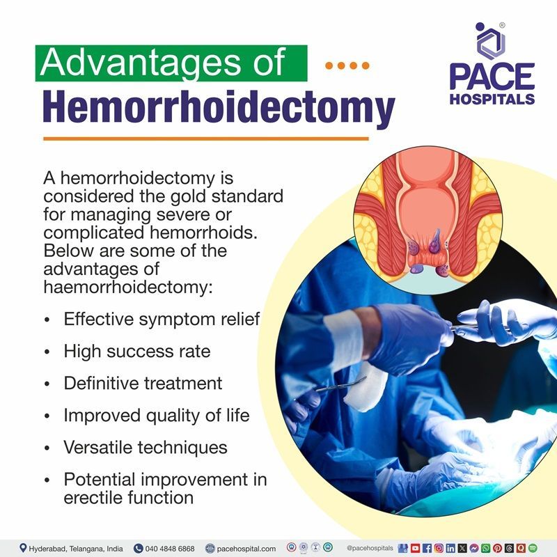 Hemorrhoidectomy advantages​ |
Advantages​ of Hemorrhoidectomy