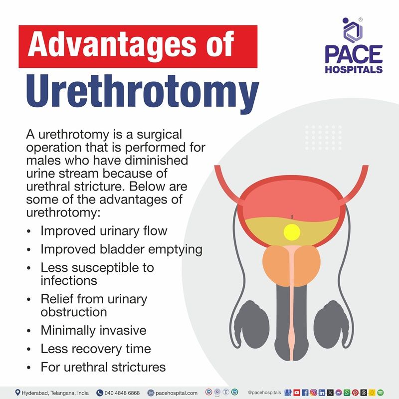 advantage of urethrotomy surgery | urethrotomy surgery benefit | urethrotomy procedure advantage | internal urethrotomy for treatment of urethral strictures