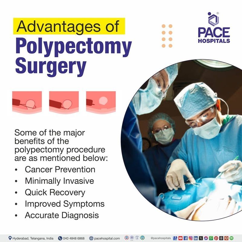 Advantages of colonoscopic polypectomy, nasal polypectomy, rectal polypectomy, colonoscopy with snare polypectomy