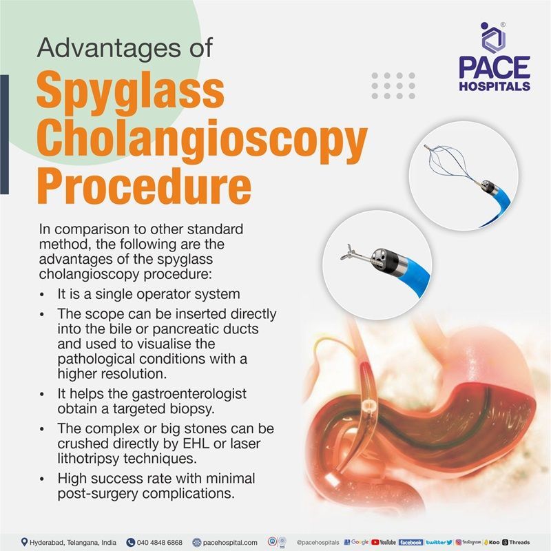 Advantages of Spyglass Cholangioscopy technique Advantages of Spyglass Cholangioscopy technique | Best Hospital for Spyglass Cholangioscopy Procedure in Hyderabad, India
