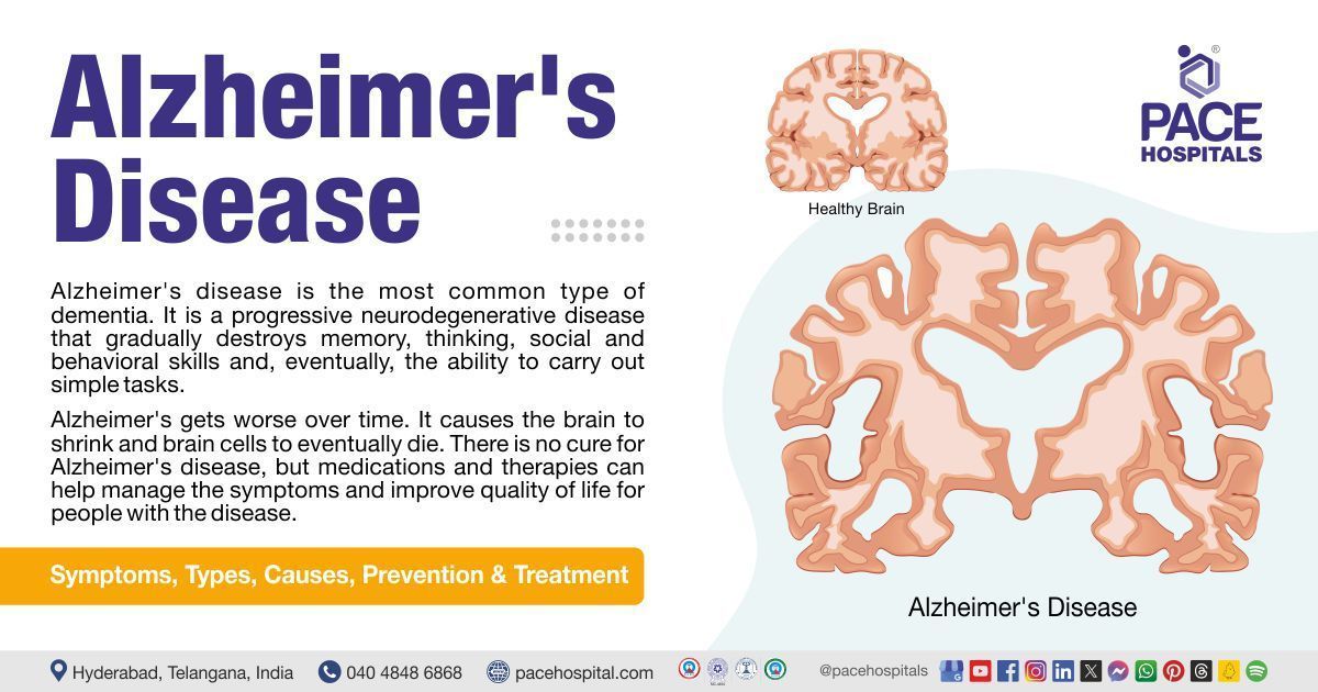 what is Alzheimer's disease | Alzheimer's disease meaning | Alzheimer's disease treatment near me