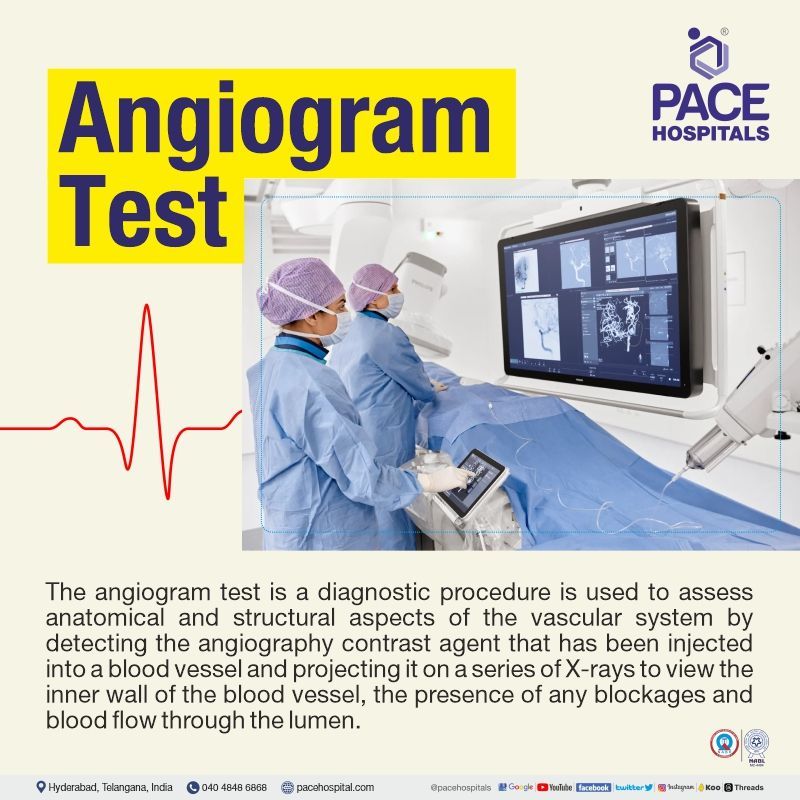 angiogram cost in hyderabad | best cardiac hospital for angiogram test in hyderabad | angiography price in hyderabad, telangana, india