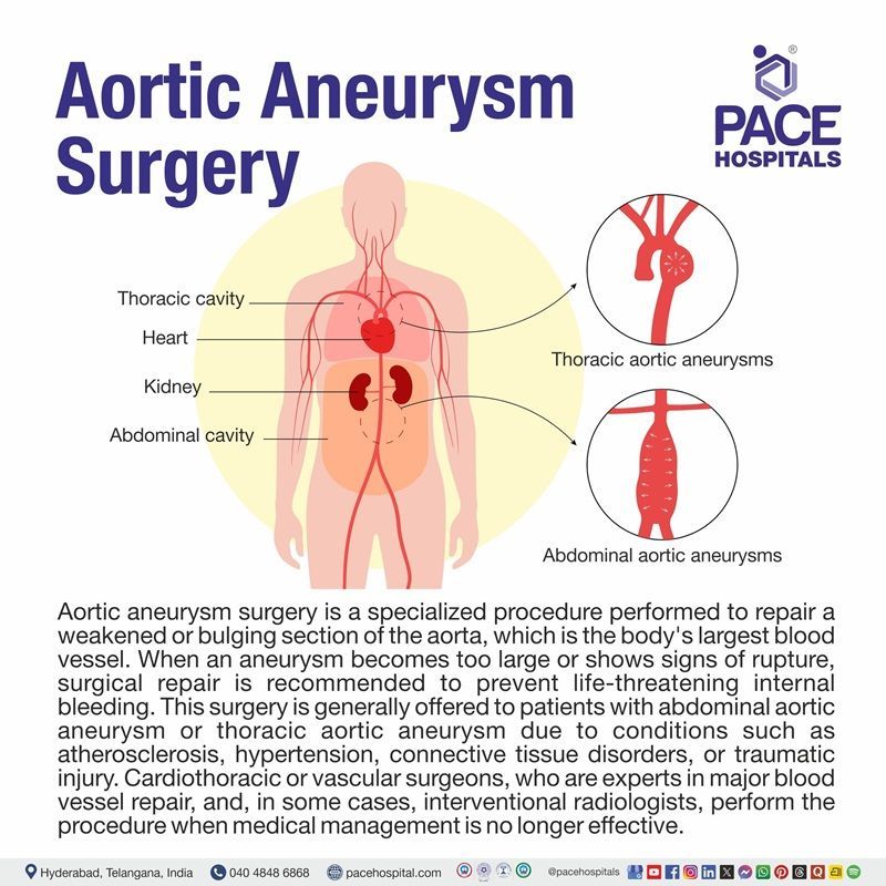 Aortic Aneurysm Meaning? | Visual depicting the meaning of aortic aneurysm surgery