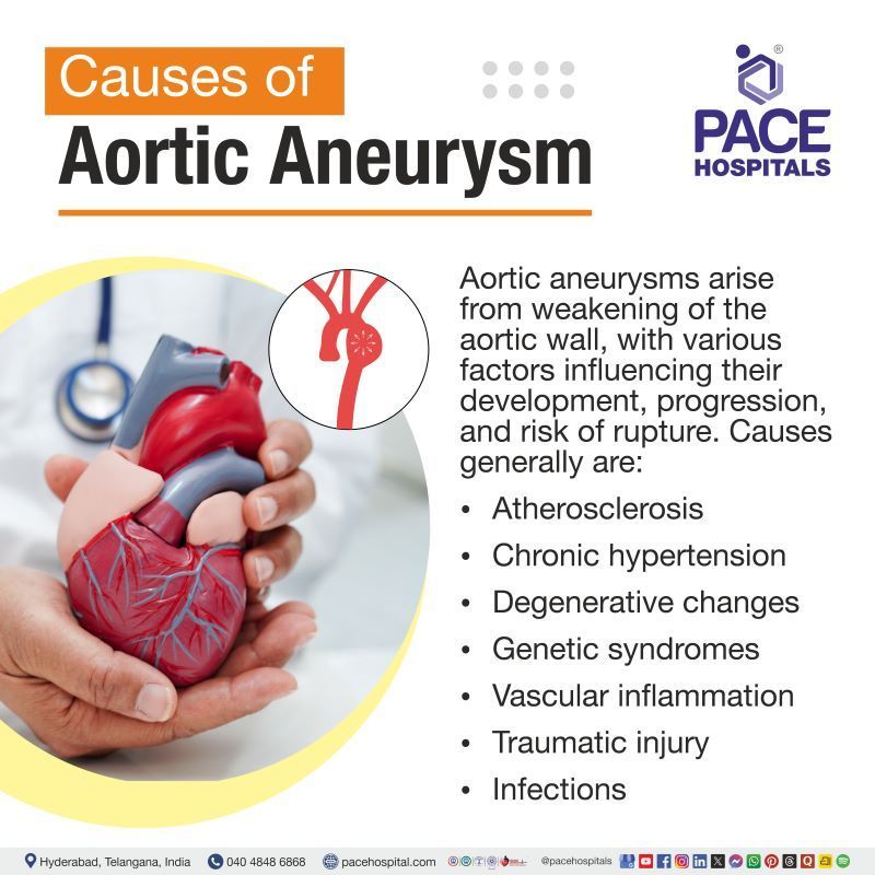 Aortic Aneurysm Causes | Most common cause of aortic aneurysm | Causes of Aortic Aneurysm