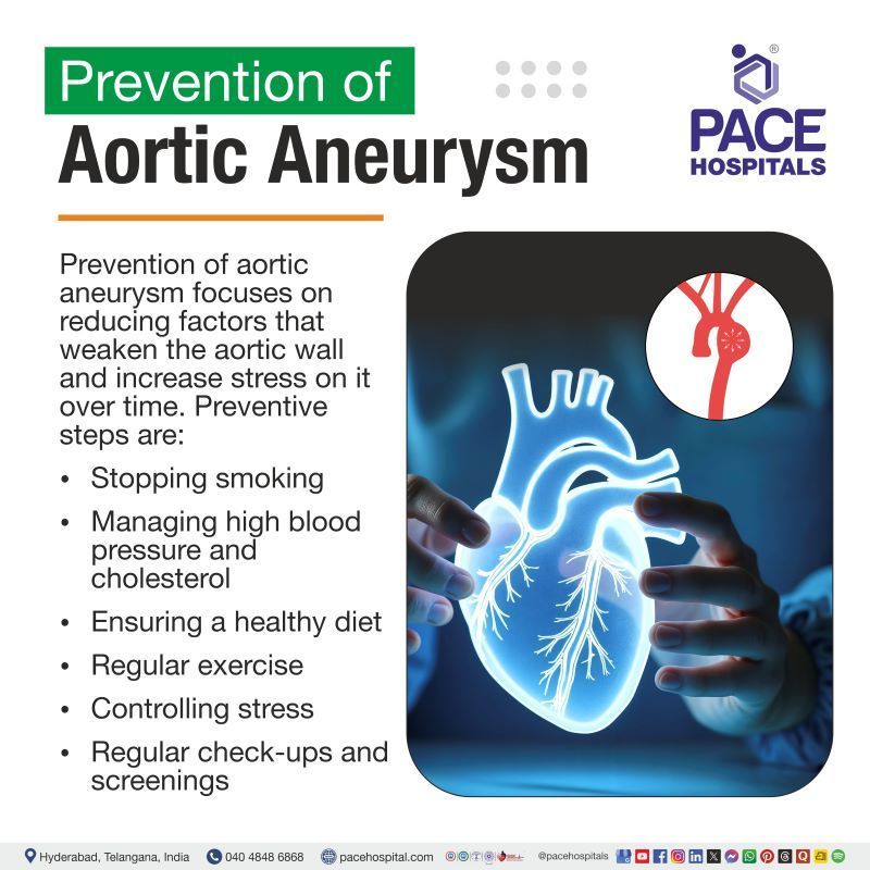 Aortic Aneurysm Prevention | How to prevent aortic aneurysm​