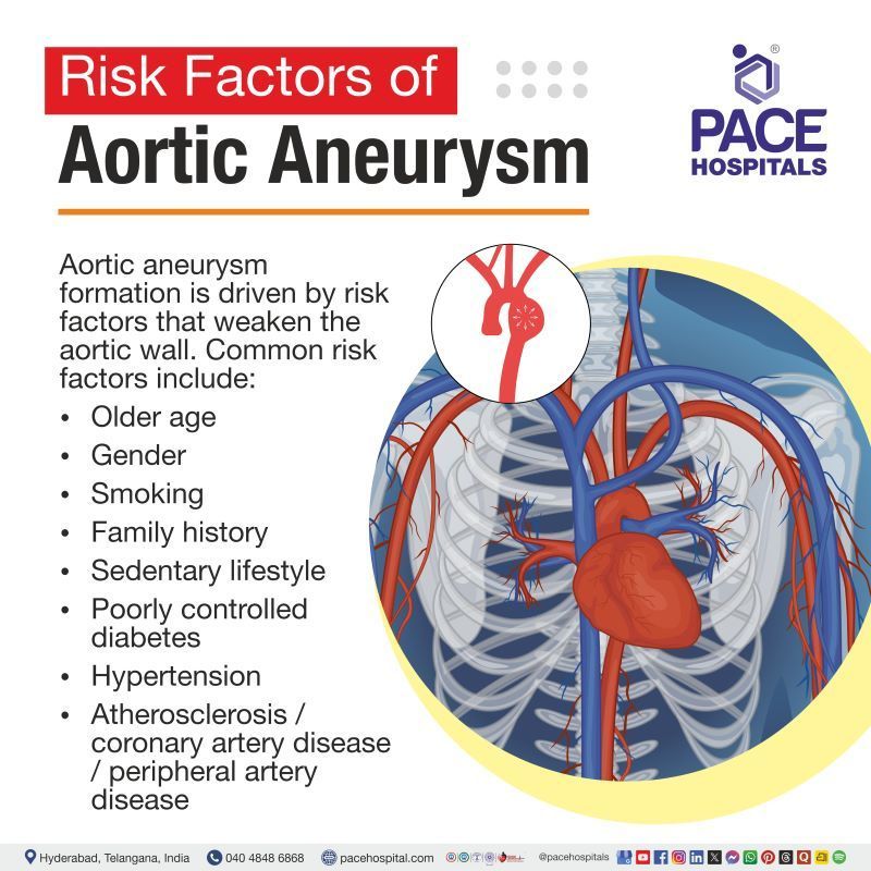 Aortic Aneurysm Risk Factors | Risk factors for Aortic Aneurysm