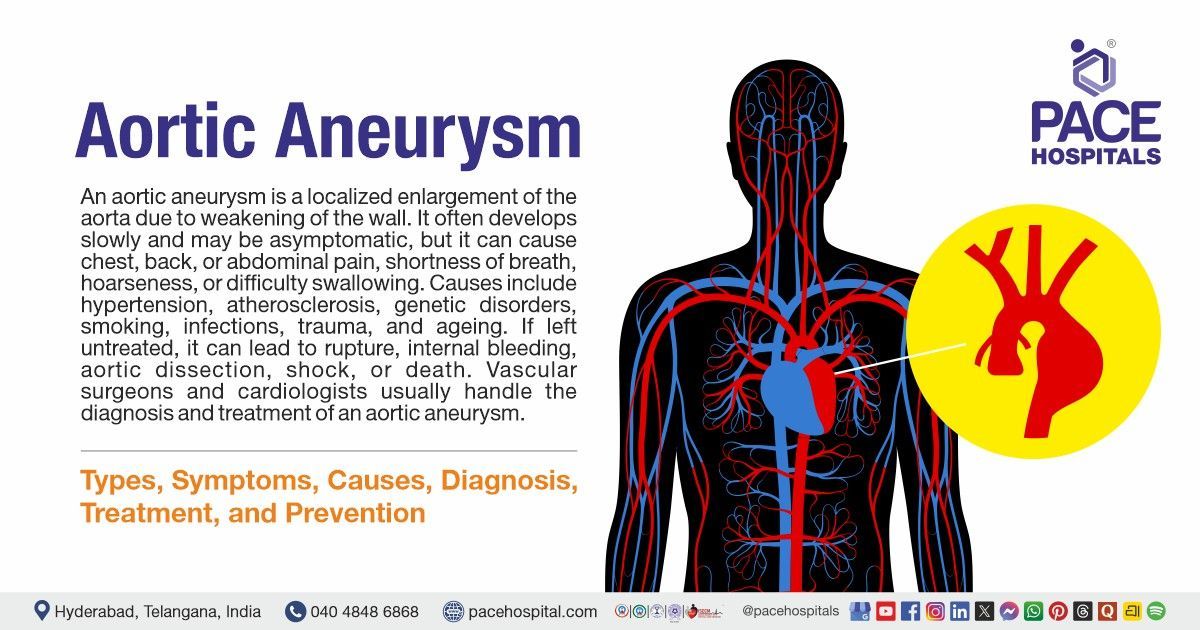 Aortic Aneurysms symptoms, causes, types, diagnosis & treatment | What is Aortic Aneurysms