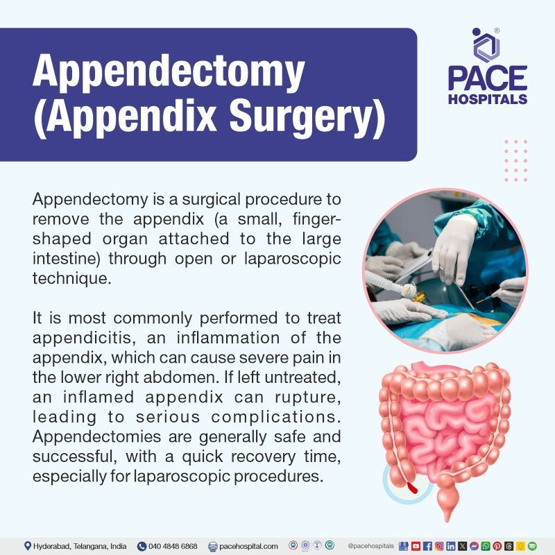 appendectomy definition | best appendix removal surgery hospitals in Hyderabad | appendectomy surgery cost in Hyderabad | keyhole surgery appendix Hyderabad | appendix laparoscopic surgery cost in Hyderabad India