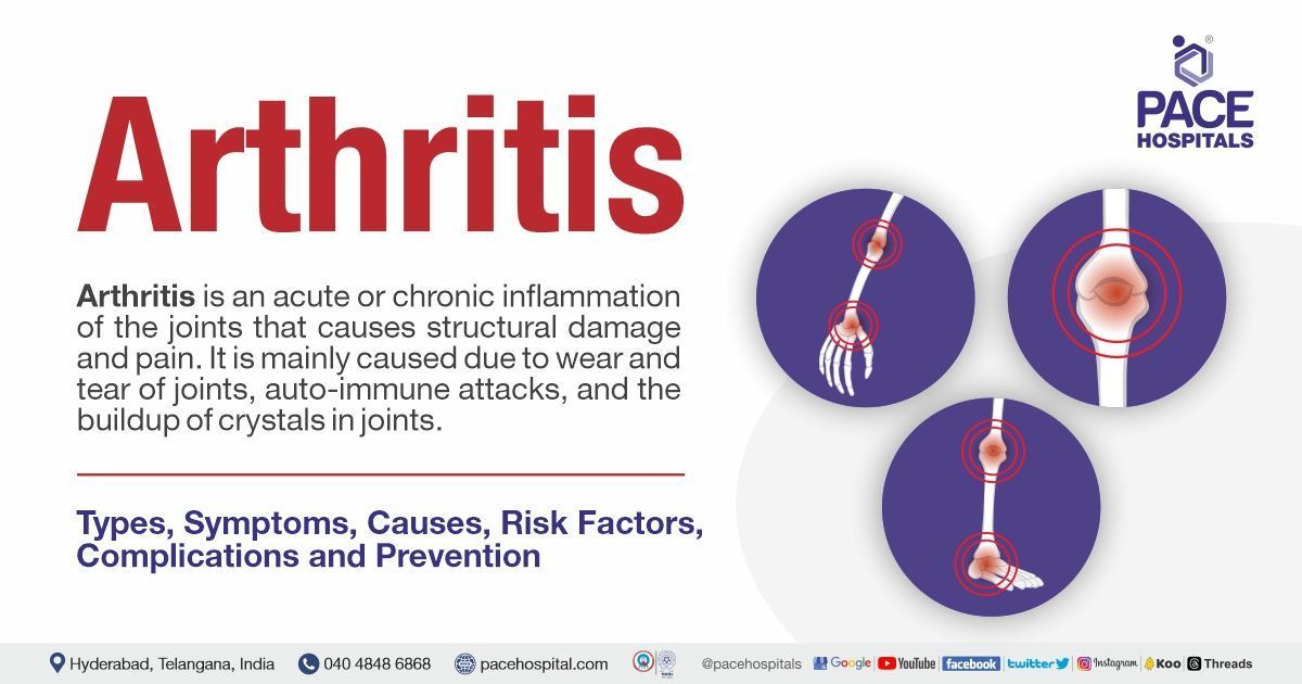 Arthritis: Symptoms, Types, Causes, Risk Factors, Complications