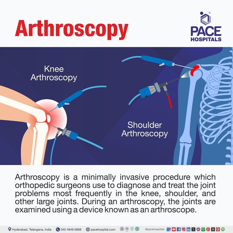 What is Arthroplasty? What is arthroplasty | arthroplasty meaning | joint replacement | bipolar hip arthroplasty | hip arthroplasty in Hyderabad, India