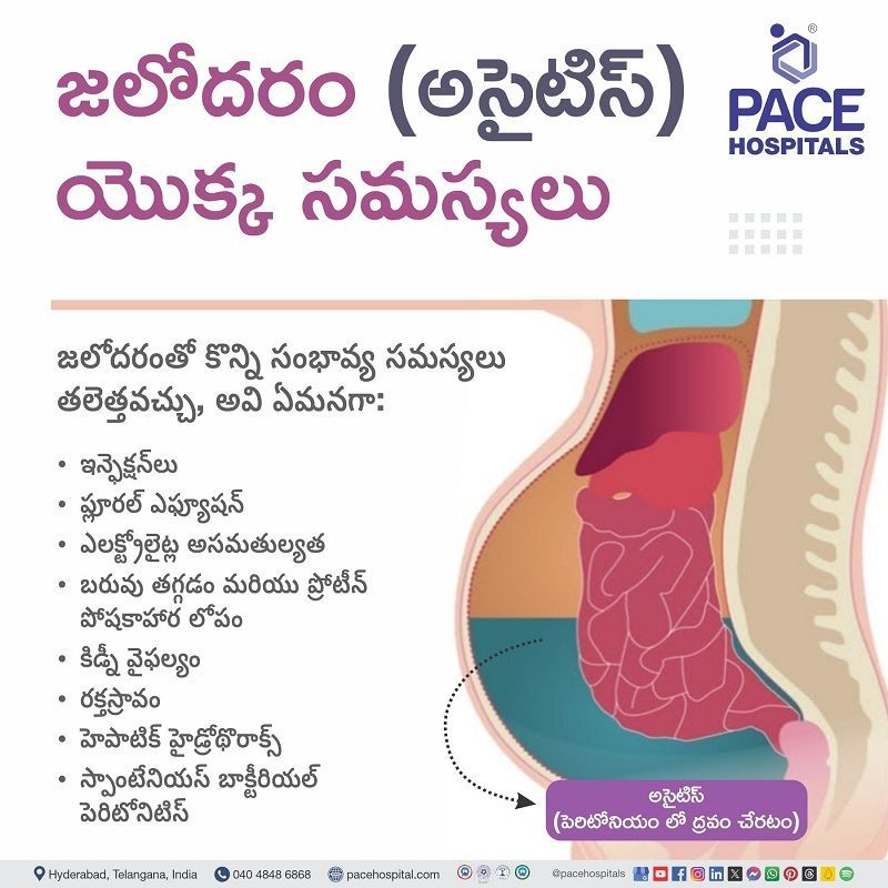 ascites complication in telugu | complication of ascites in telugu | ascites risk in telugu