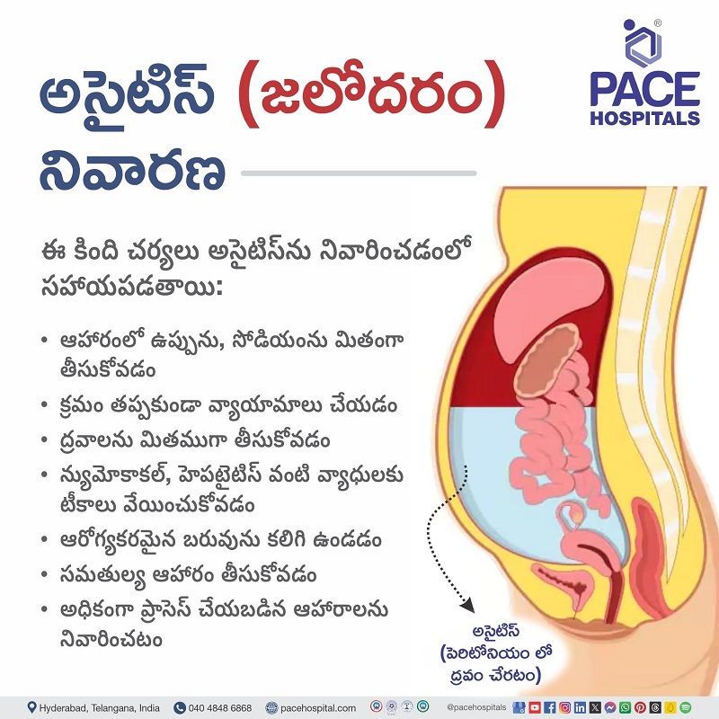 ascites prevention in telugu | prevention of ascites in telugu