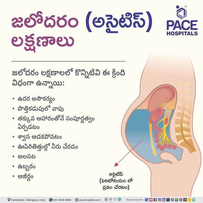 ascites symptom in telugu | symptom of ascites in telugu | sign of ascites in telugu