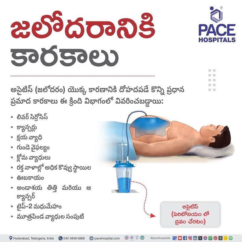 ascites risk factor in telugu | risk factor of ascites in telugu