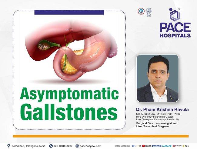 Asymptomatic or Symptom-Less Gallstones - All you need to Know