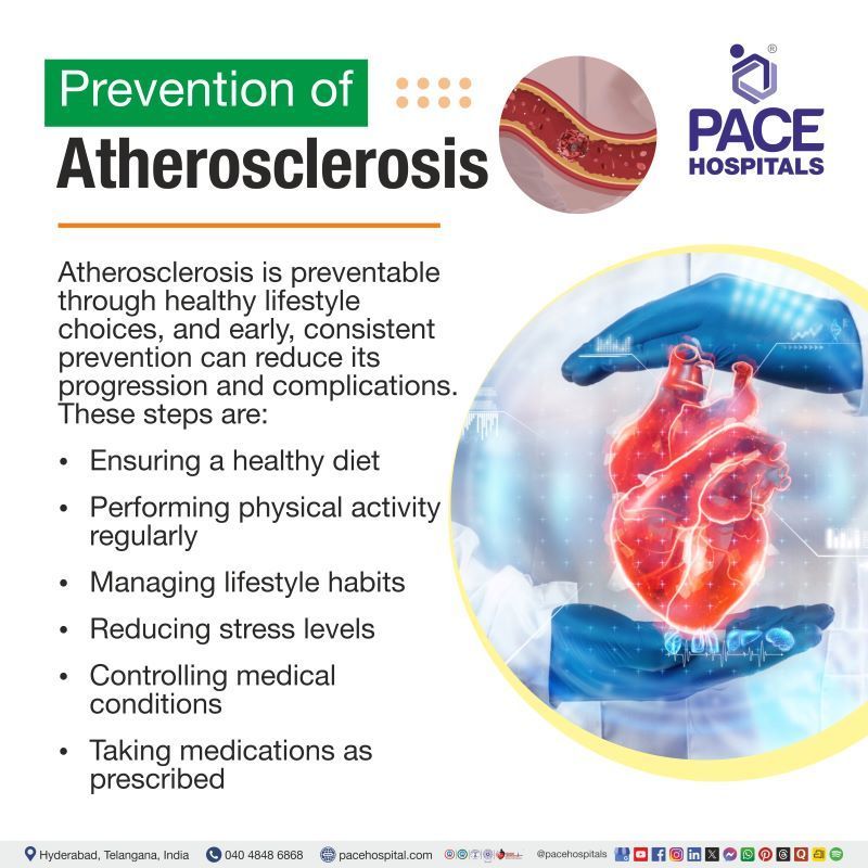Atherosclerosis Prevention | Primary prevention of atherosclerosis | Atherosclerosis prevention and control