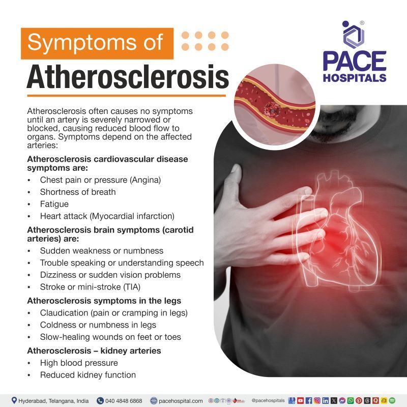 Atherosclerosis Symptoms | Signs and symptoms of atherosclerosis