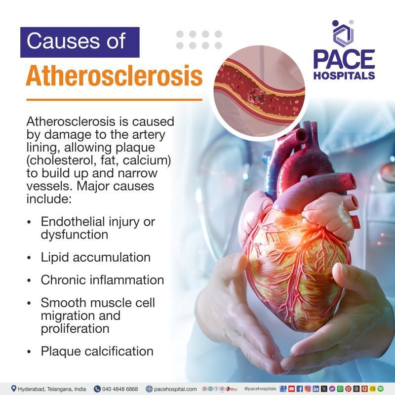 Atherosclerosis Causes | What causes atherosclerosis