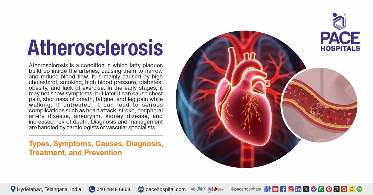 Atherosclerosis Symptoms, Causes, Types, Diagnosis and Treatment | What is Atherosclerosis