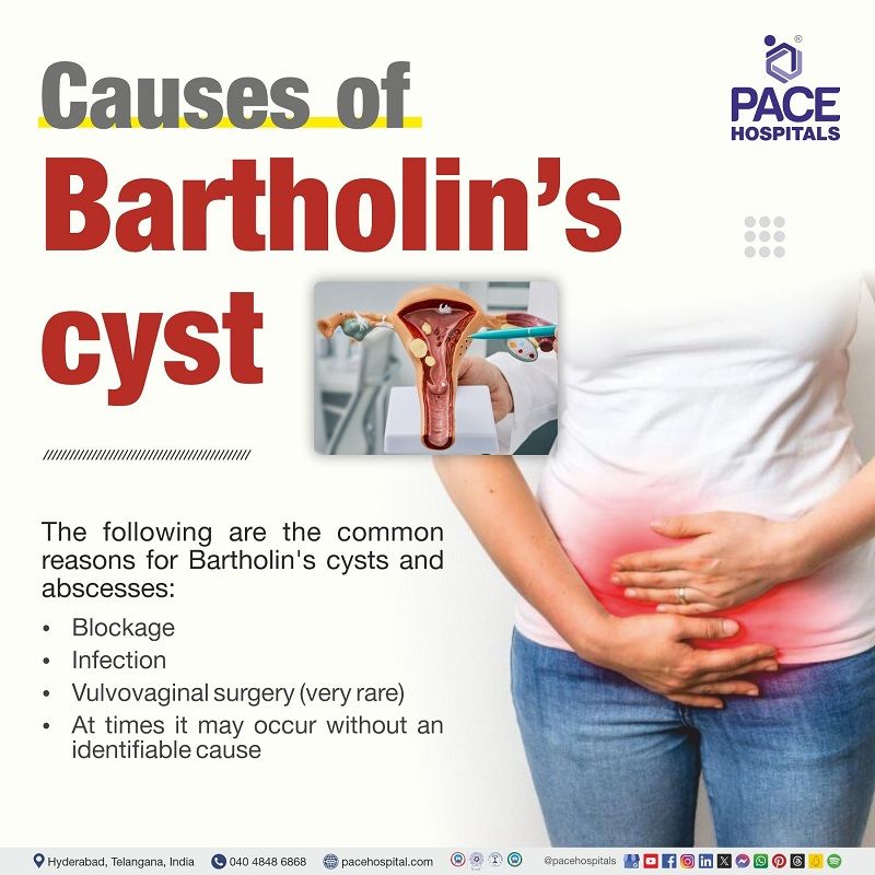 what causes Bartholin's cyst and abscess | causes of Bartholin's cyst and abscess | Bartholin's cyst causes 
| Visual explaining the causes of Bartholin's cyst