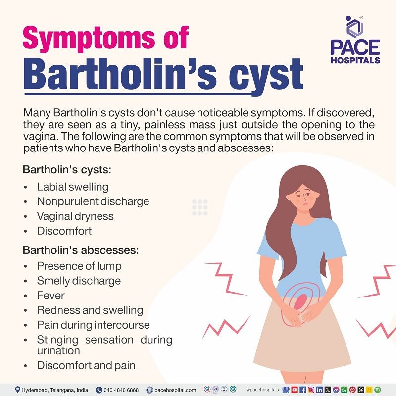 Bartholin's cyst symptoms | Bartholin's gland cyst signs and symptoms | Symptoms of Bartholin's cyst | Visual depicting the symptoms of Bartholin's cyst