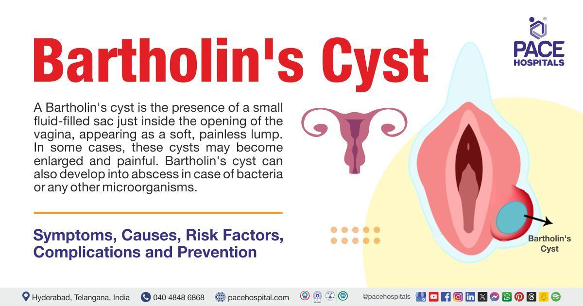 Bartholin's cyst | Bartholin's cyst symptoms |Bartholin vs Gartner's cyst |What is Bartholin's cyst