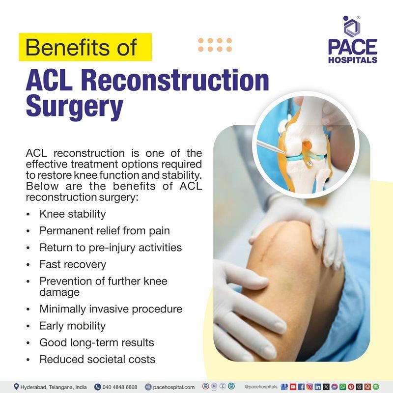 ACL Reconstruction Surgery Benefits Benefits of ACL Reconstruction Surgery | Advantages of ACL Reconstruction
