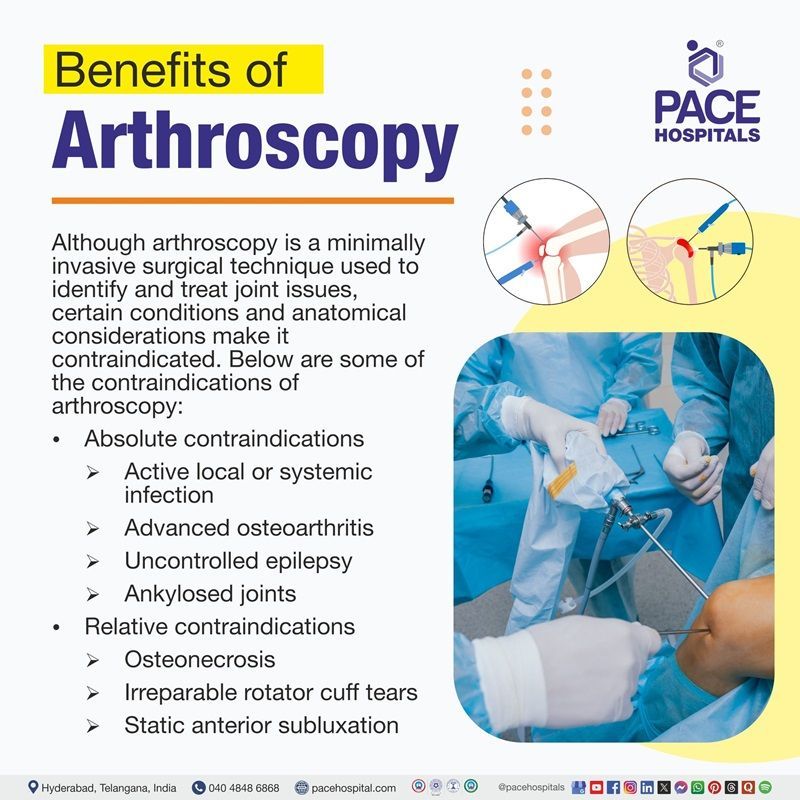 Benefits of arthroscopy​ | advantages of arthroscopy​