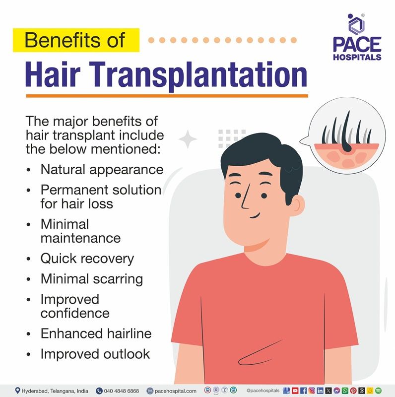 benefits of hair transplant | benefits of fue hair transplant | hair transplant benefits and side effects