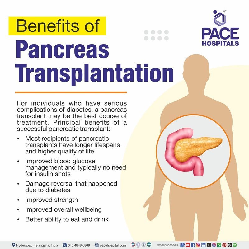 benefits of pancreas transplantation | ​Visual depicting the benefits  of pancreas transplant
