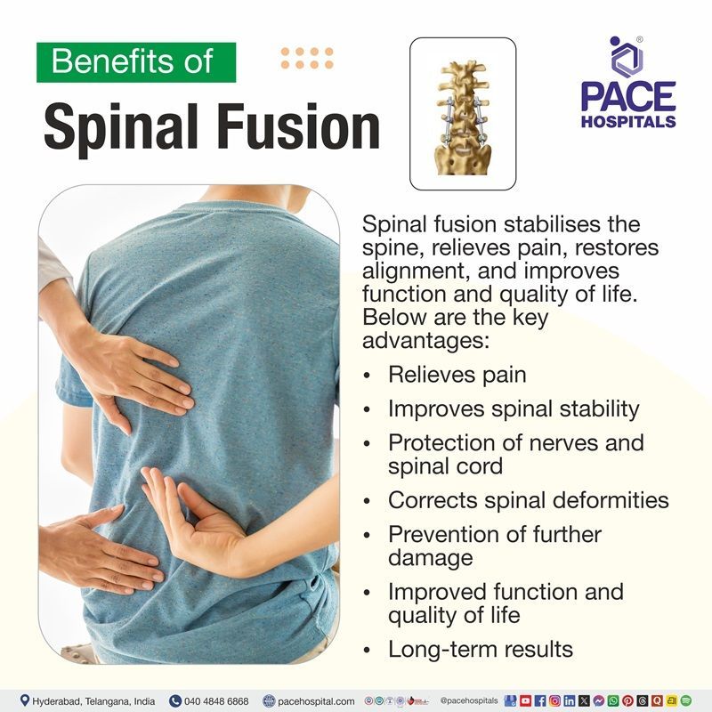 Spinla Fusion surgery benefits | Advantages of spinal fusion surgery