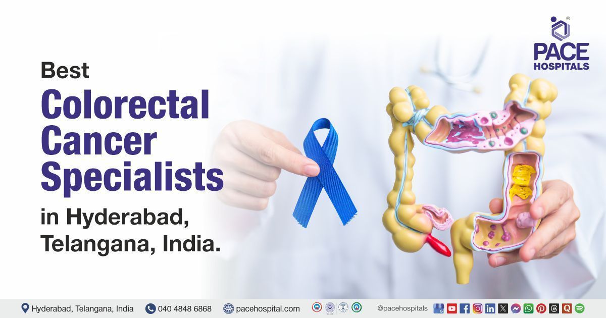 colorectal cancer doctors​ | best colon cancer doctors​ in Hyderabad | Colorectal Cancer Specialists