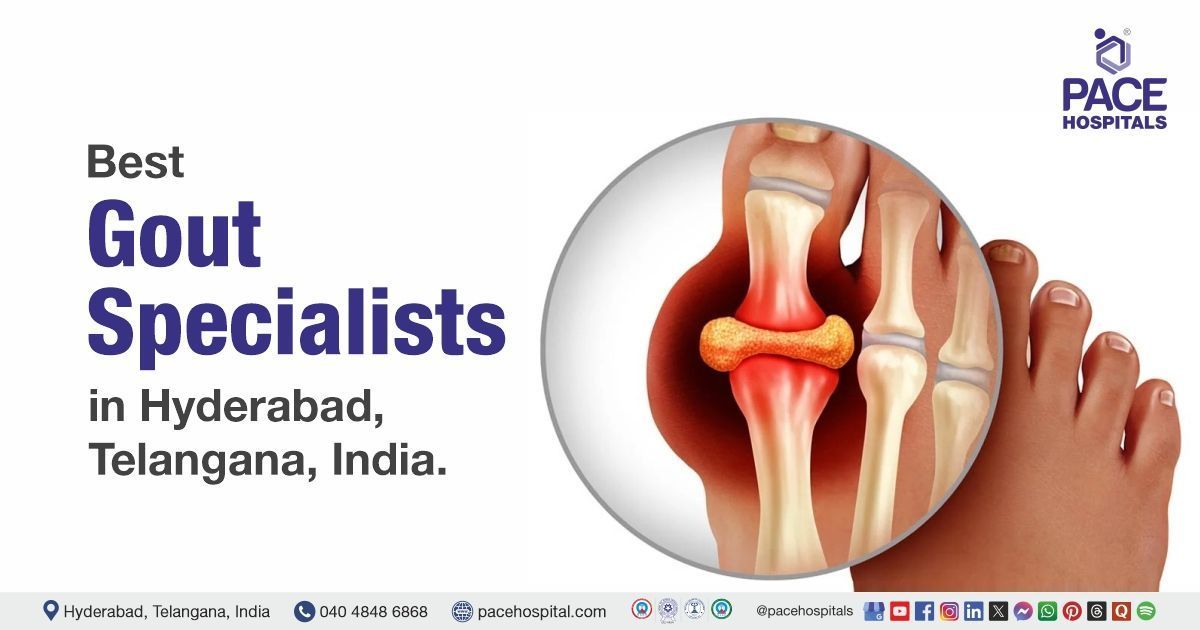 Best Gout Specialist Doctor in Hyderabad, India | Gout Specialist