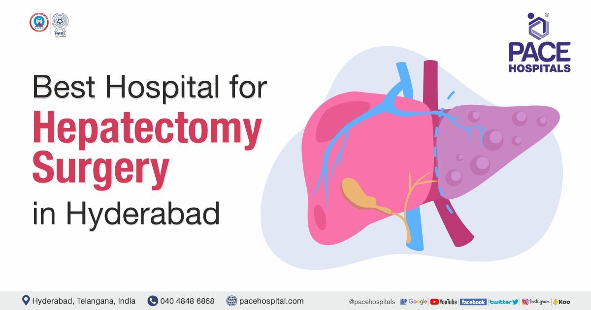 Hepatectomy Surgery in Hyderabad - Types, Procedure Indications & Cost