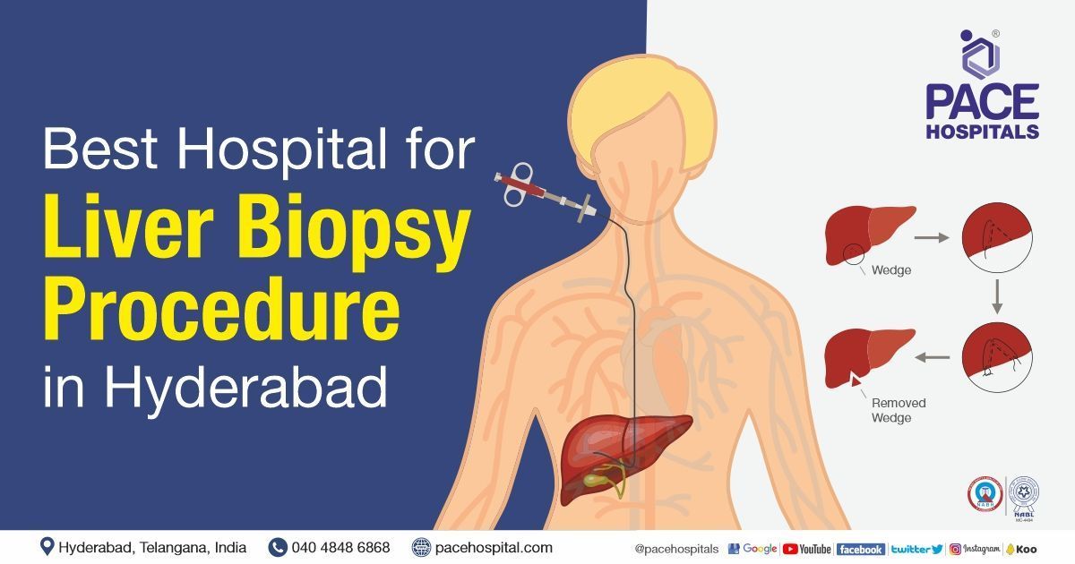 pin-on-liver-biopsy-procedure