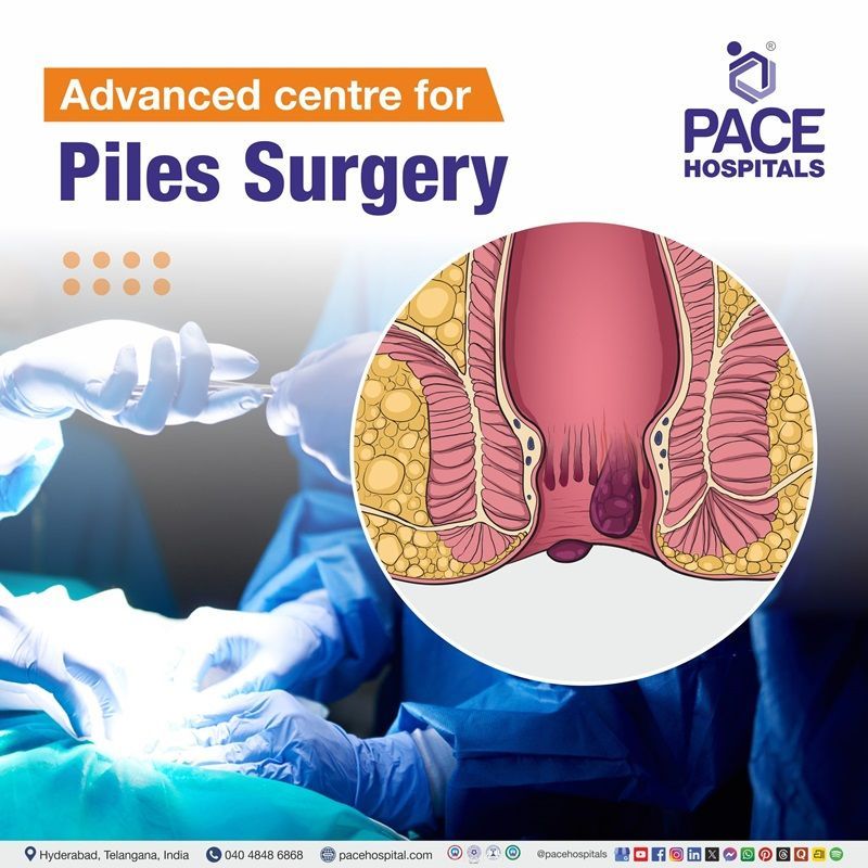 Best Hospital forPiles Surgery in Hyderabad | Advanced center for Piles operation in Hyderabad, India