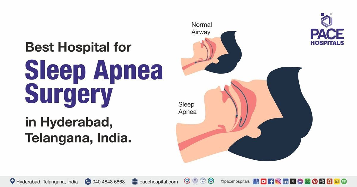 obstructive sleep apnea surgery in Hyderabad India | laser surgery for snoring and sleep apnea