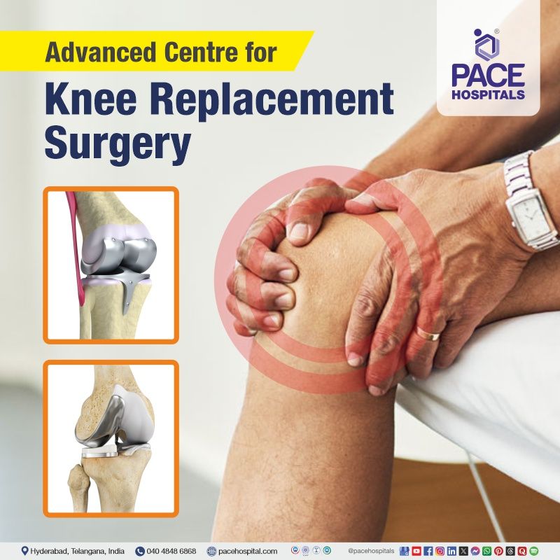 Best Hospital for Knee Replacement in Hyderabad | Top Knee Joint Replacement Surgery in Hyderabad | Famous Knee Replacement Surgery Hospital in Telangana, India