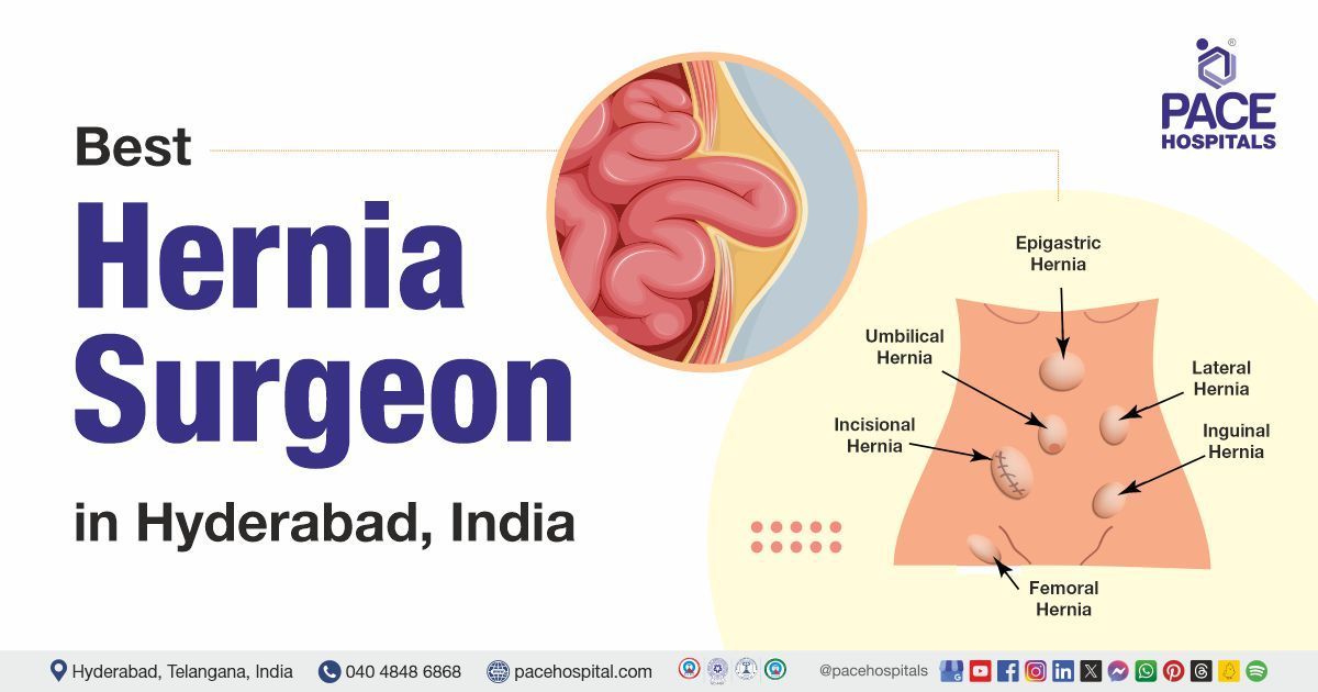 hernia specialist doctor in Hyderabad | best hernia surgeon in Hyderabad India | hernia treatment