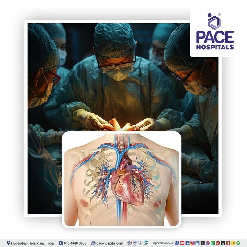 Top Cardiothoracic and Vascular Surgery at PACE Hospitals, Hyderabad Best Hospital for cardiovascular & thoracic surgery in Hyderabad with Expert CTVS surgeons | Best cardiothoracic hospitals