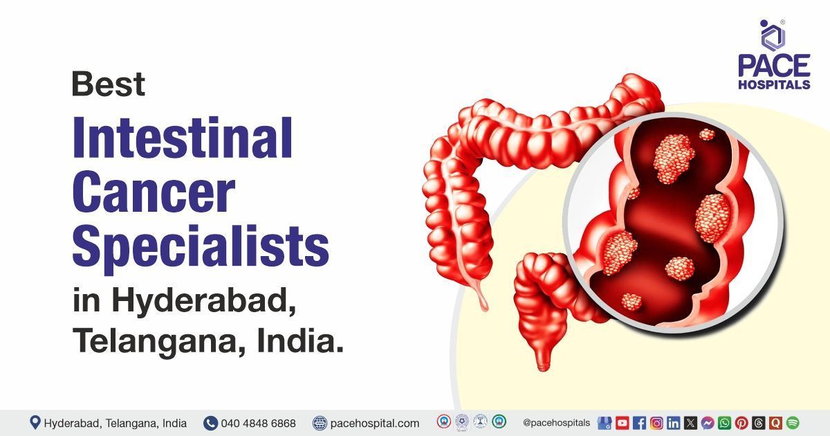 Best Doctors for Intestinal Cancer in Hyderabad, India | Intestinal Cancer Specialist