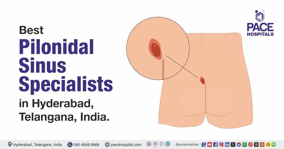 Best Doctor for Pilonidal Sinus in Hyderabad | Pilonidal Sinus Specialist Doctor