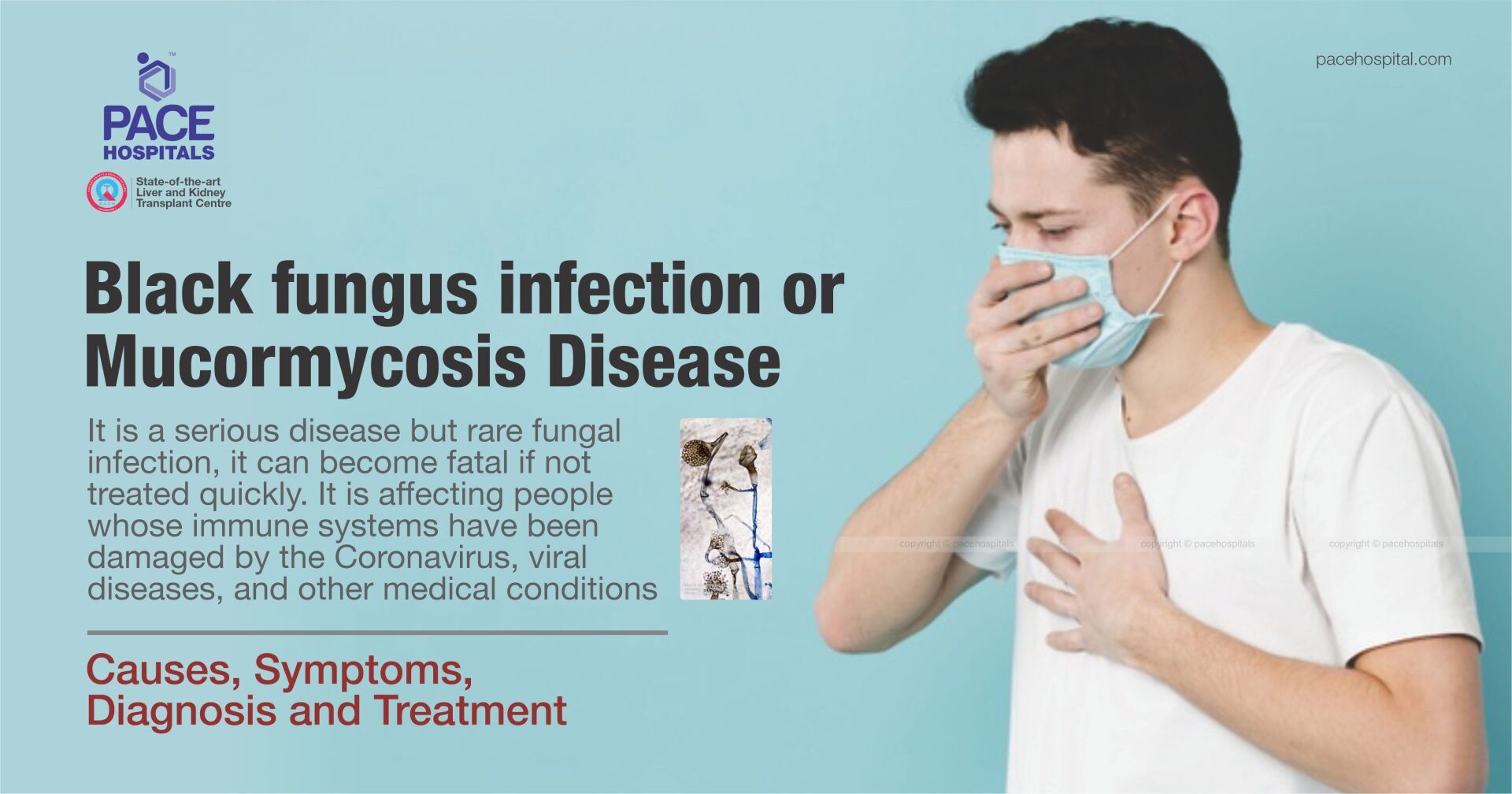 Symptoms mucormycosis Mucormycosis causes,