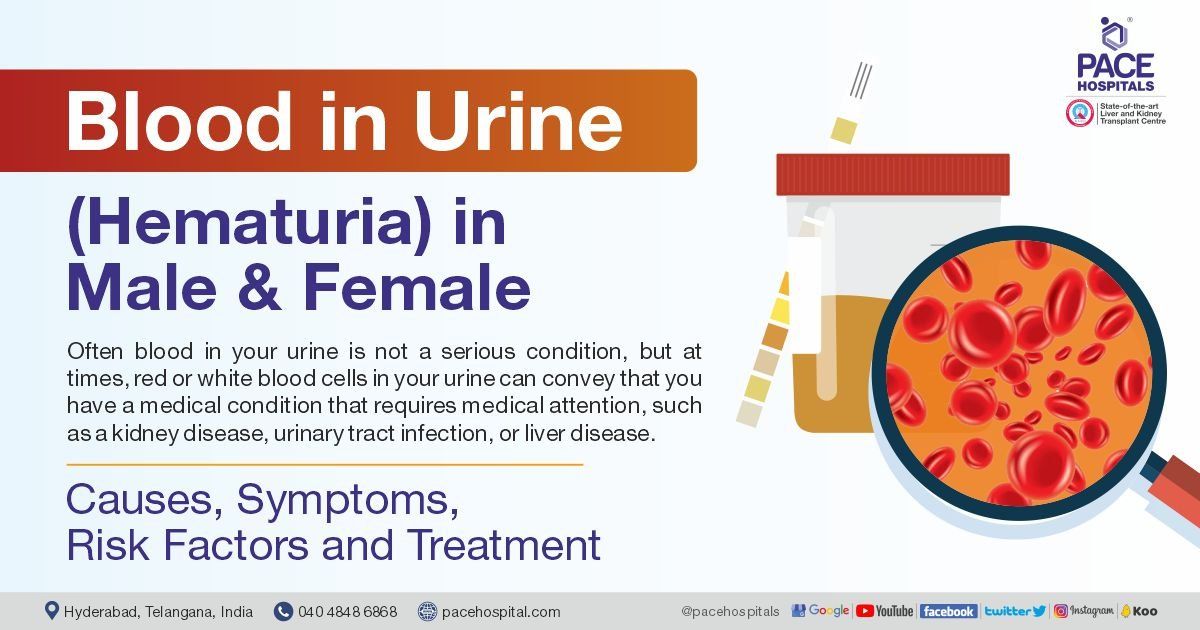 Blood in urine female